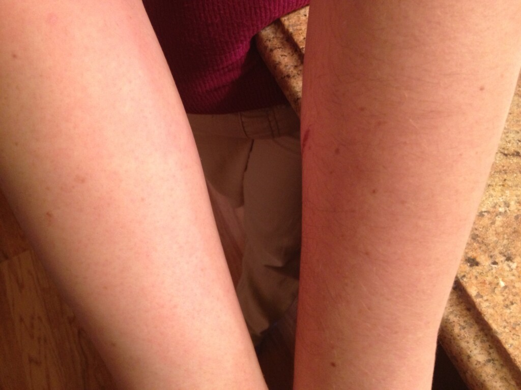 Comparing waxed arm to unwaxed arm #shop #cbias